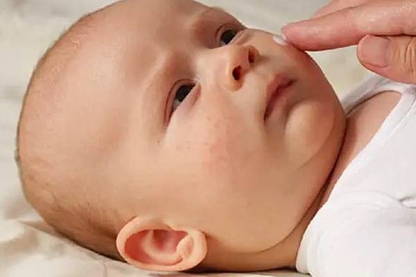 مراقبت از پوست نوزاد در دوران اگزما، اصلی مهم و حیاتی است.
